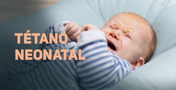 TETANO NEONATAL