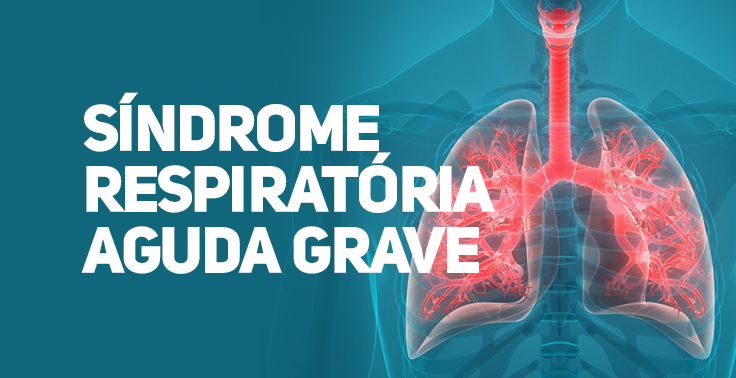 sindrome respiratoria aguda grave srag