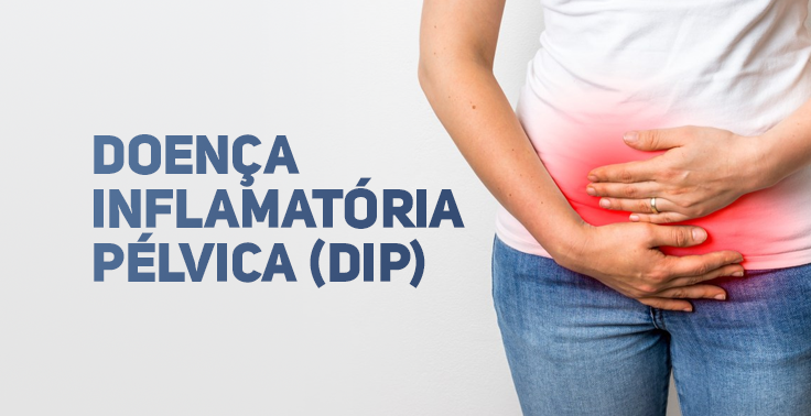 doenca inflamatoria pelvica dip